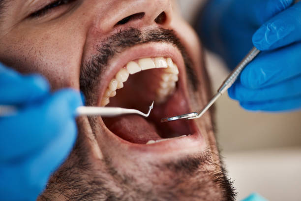 Best Broken or Cracked Tooth Emergency Dentist in Farmersville, CA
